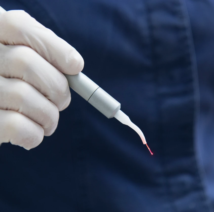 A gloved hand holding a dental laser handpiece