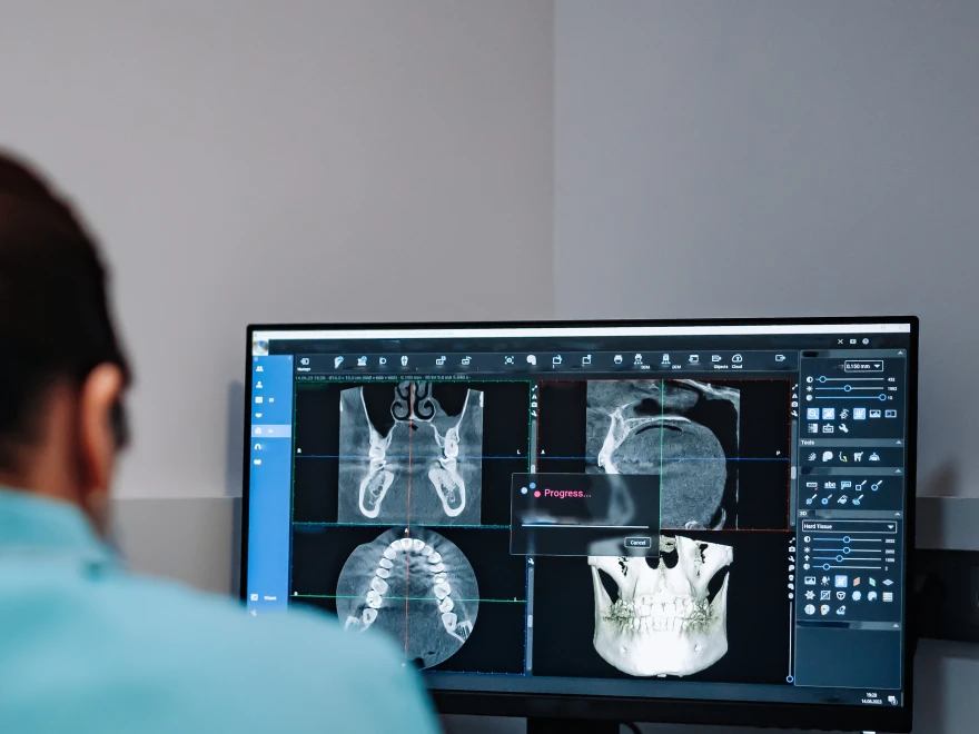 Digital dental X-ray scans displayed on a monitor